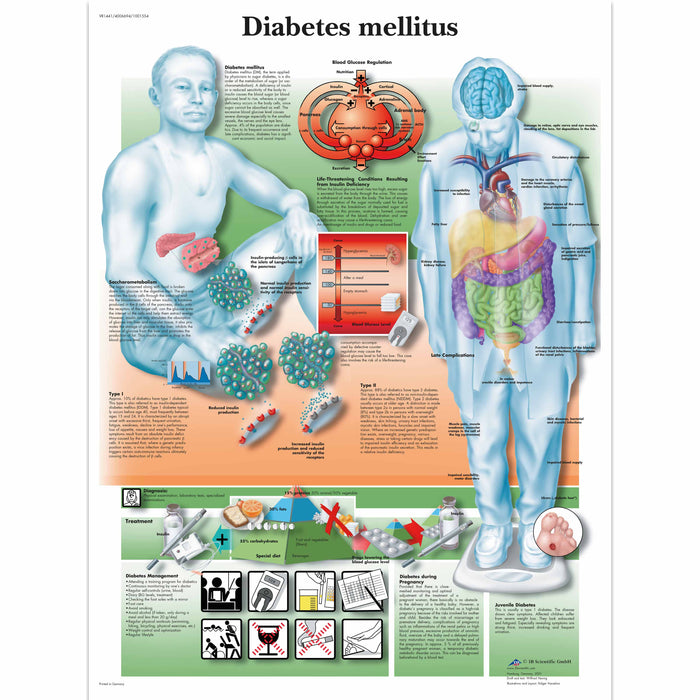 Diabetes Mellitus - Laminated