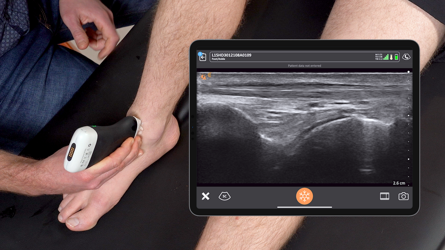 Discover the cutting-edge technology of the Clarius HD3 - the world's only 3rd generation portable ultrasound device
